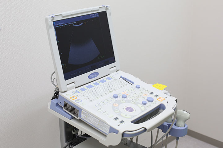 超音波検査（腹部、頸動脈、心臓） イメージ